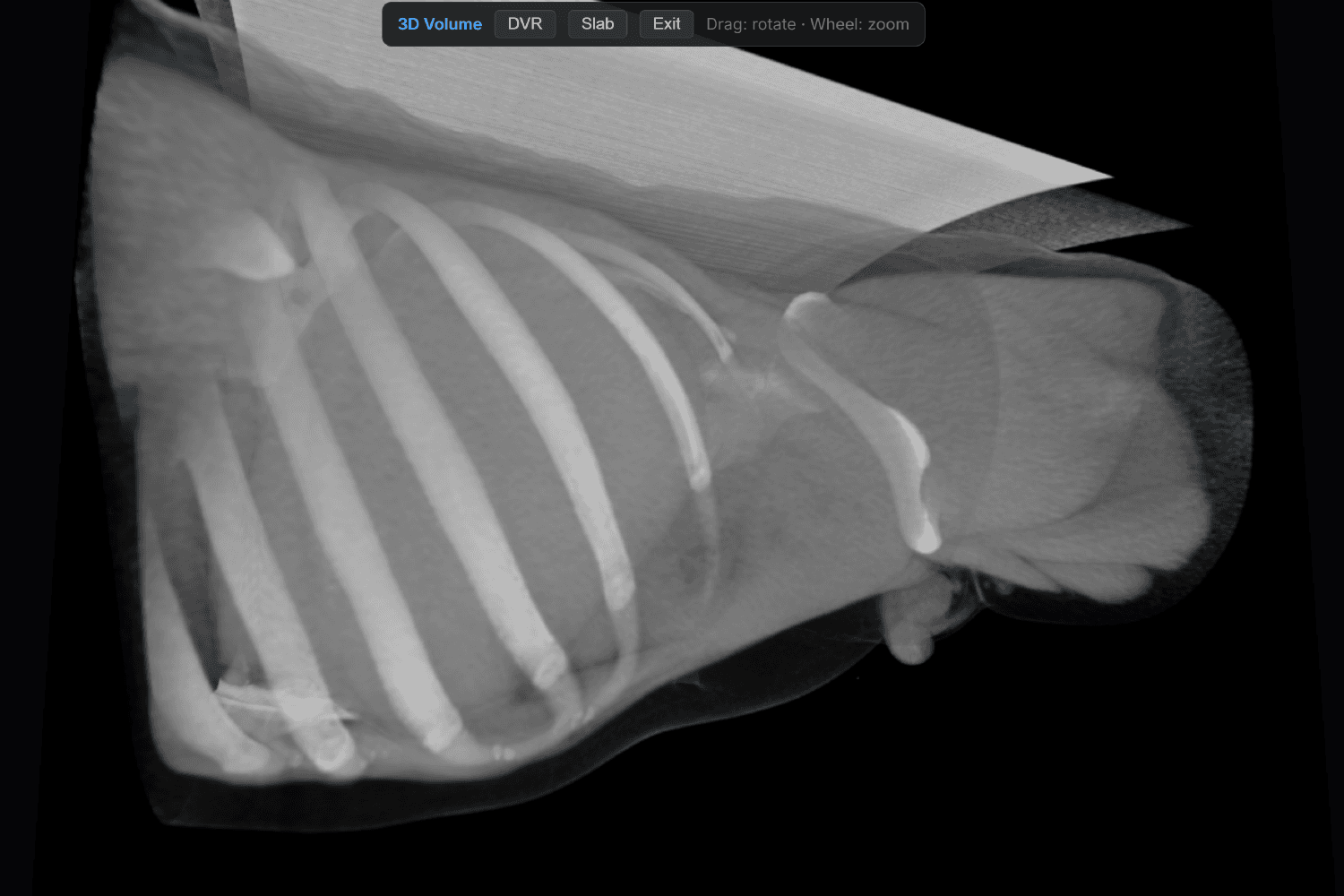 3D volume rendering.