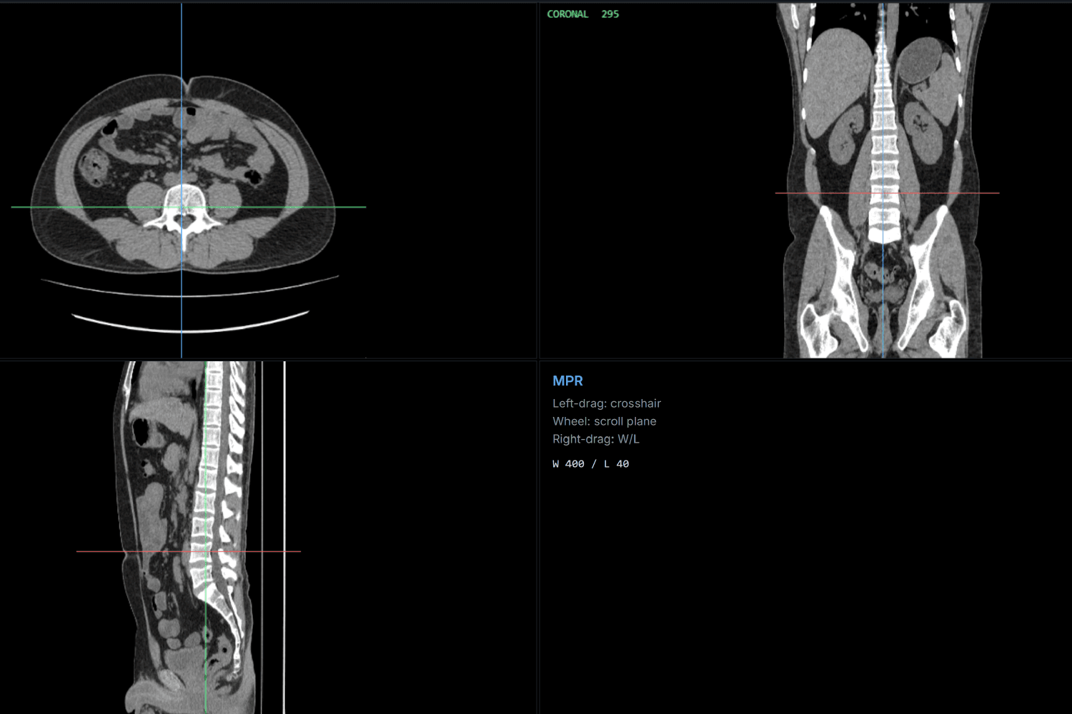 Axial, coronal, sagittal.